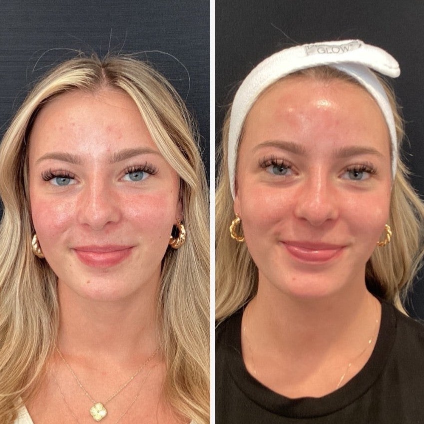 SatinSkin™ Pore Cleanser