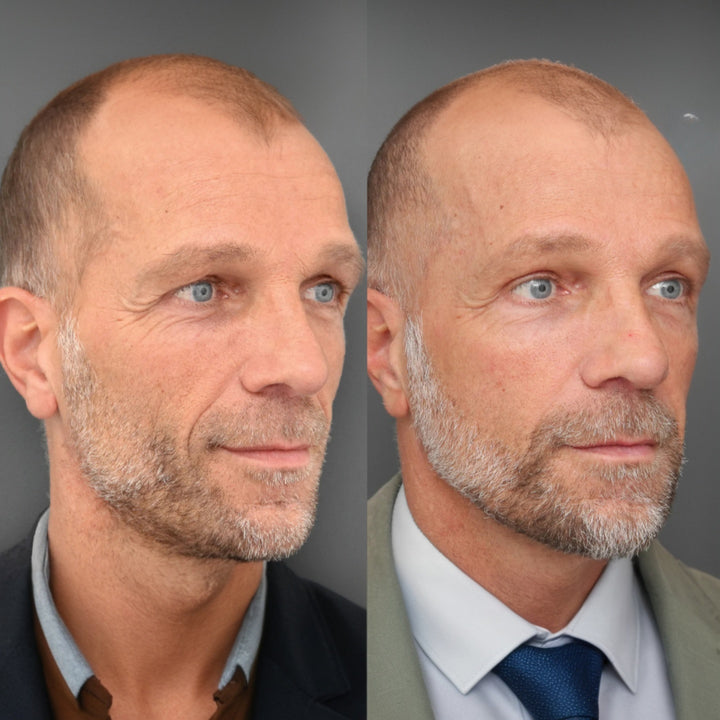 Wrinkle Defense Tallow Balm